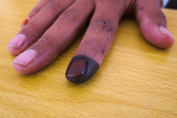 Ink marks the finger of a voter to ensure he does not vote a second time, Afghanistan April 2014
