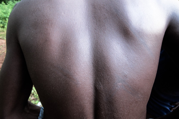 Scars still visible from lashes across the back